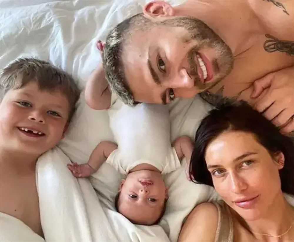 jake quickenden baby trolls botox