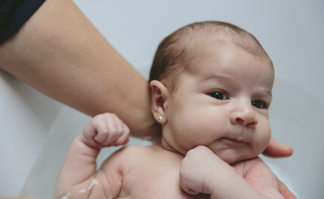 neonatal herpes